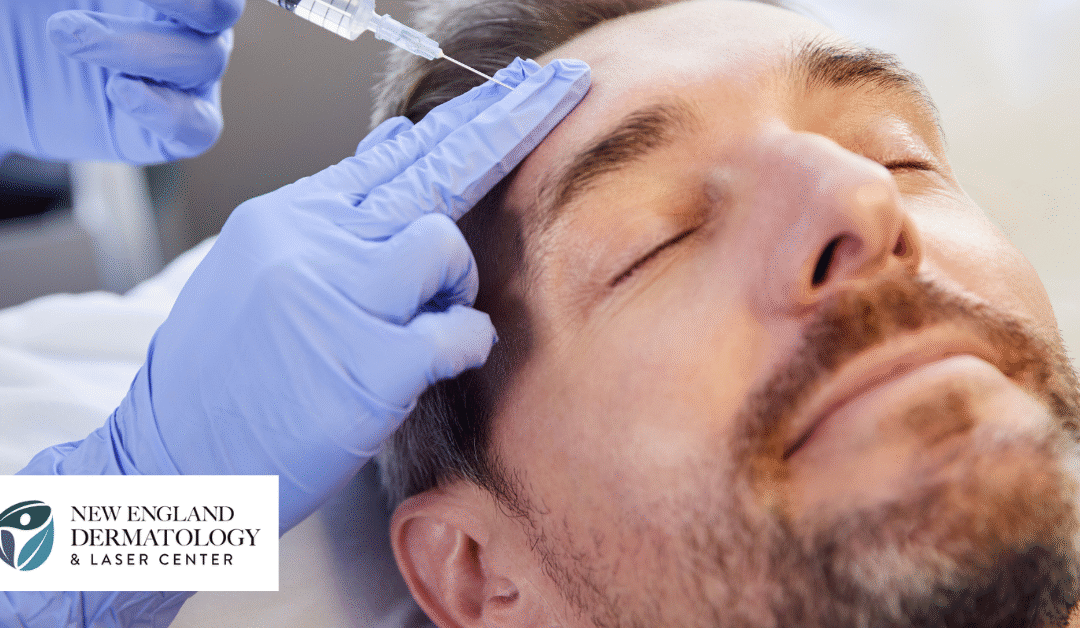 How Much Does BOTOX Cost?